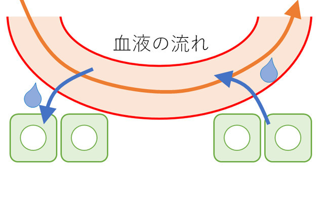 リンパ浮腫とは1